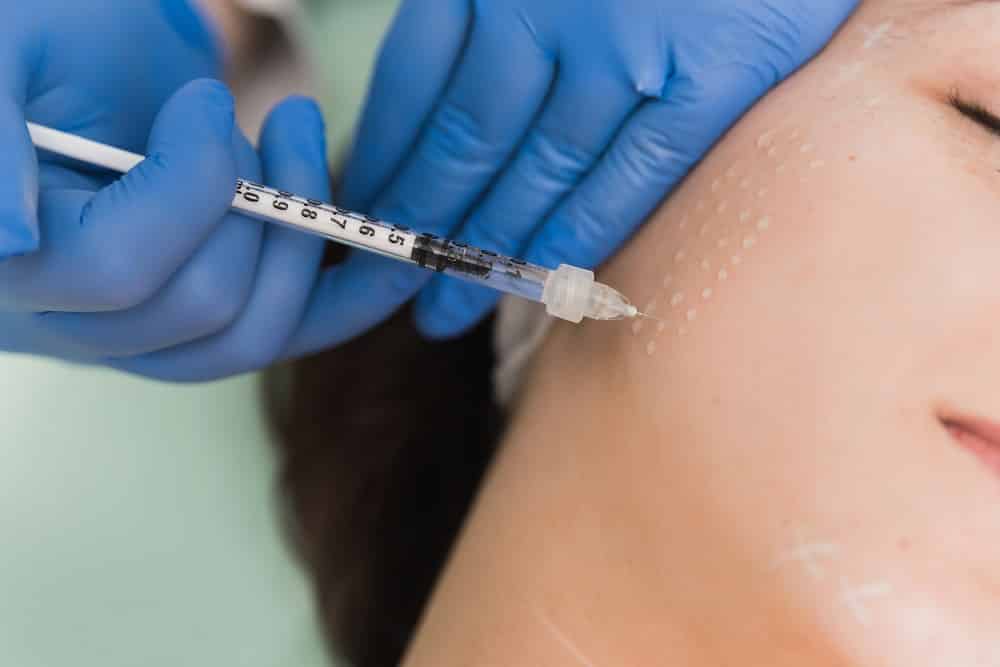 The doctor treating the chin of a patient | Get Mesotherapy at Euro Look Medical Spa in Solon, Ohio