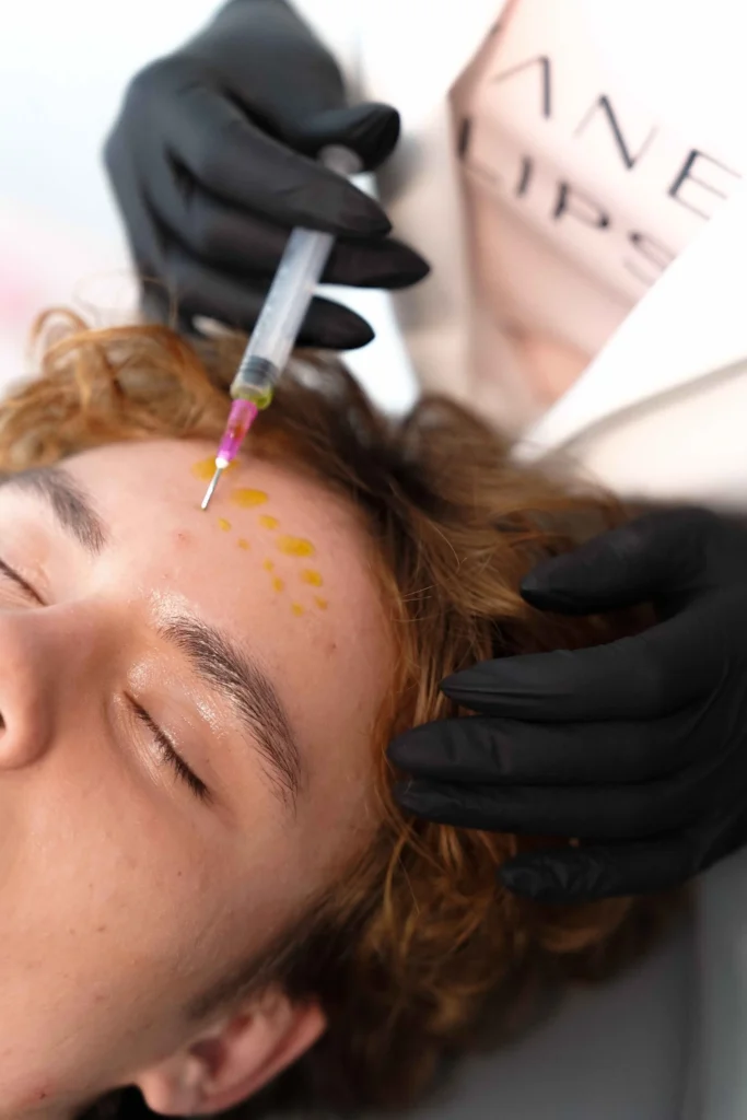 Medical Grade Chemical Peels | in Solon and Cleveland, OH | Euro Look Medspa