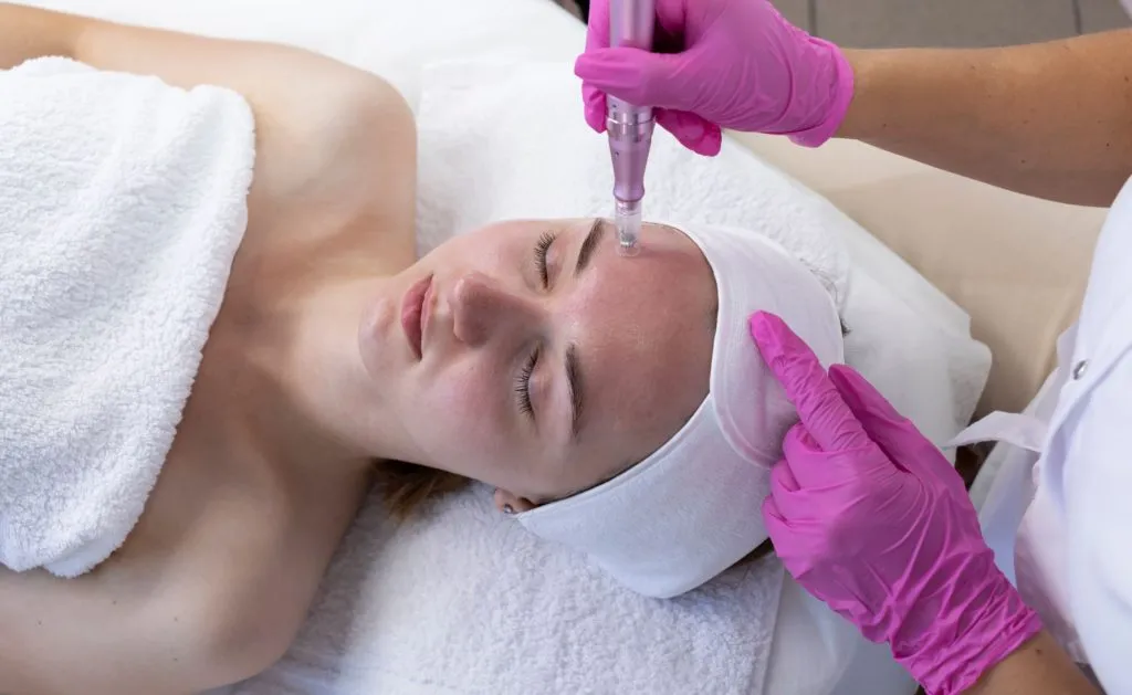 Microneedling by Euro Look Medical Spa in Solon, OH