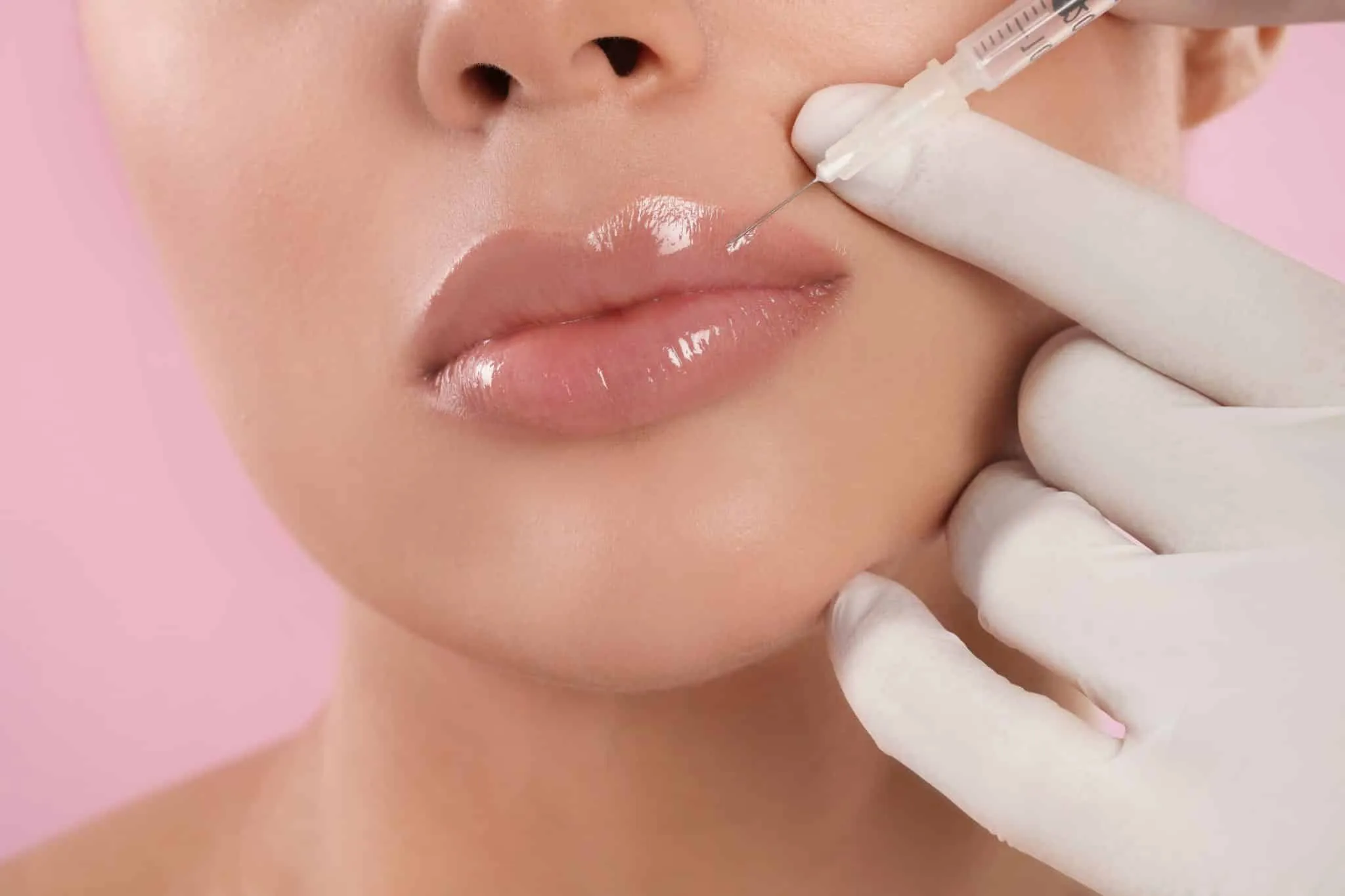 Myhts and Facts About Lip Filler Treatment in Solon, OH