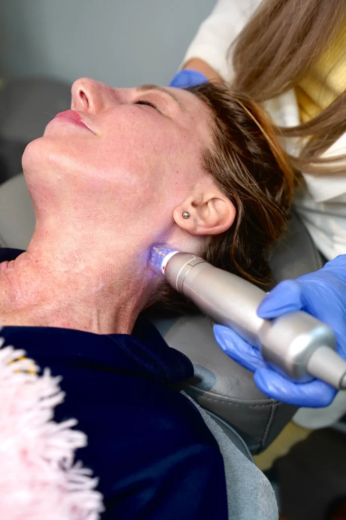 Microneedling in Solon, OH | Euro Look Medical Spa