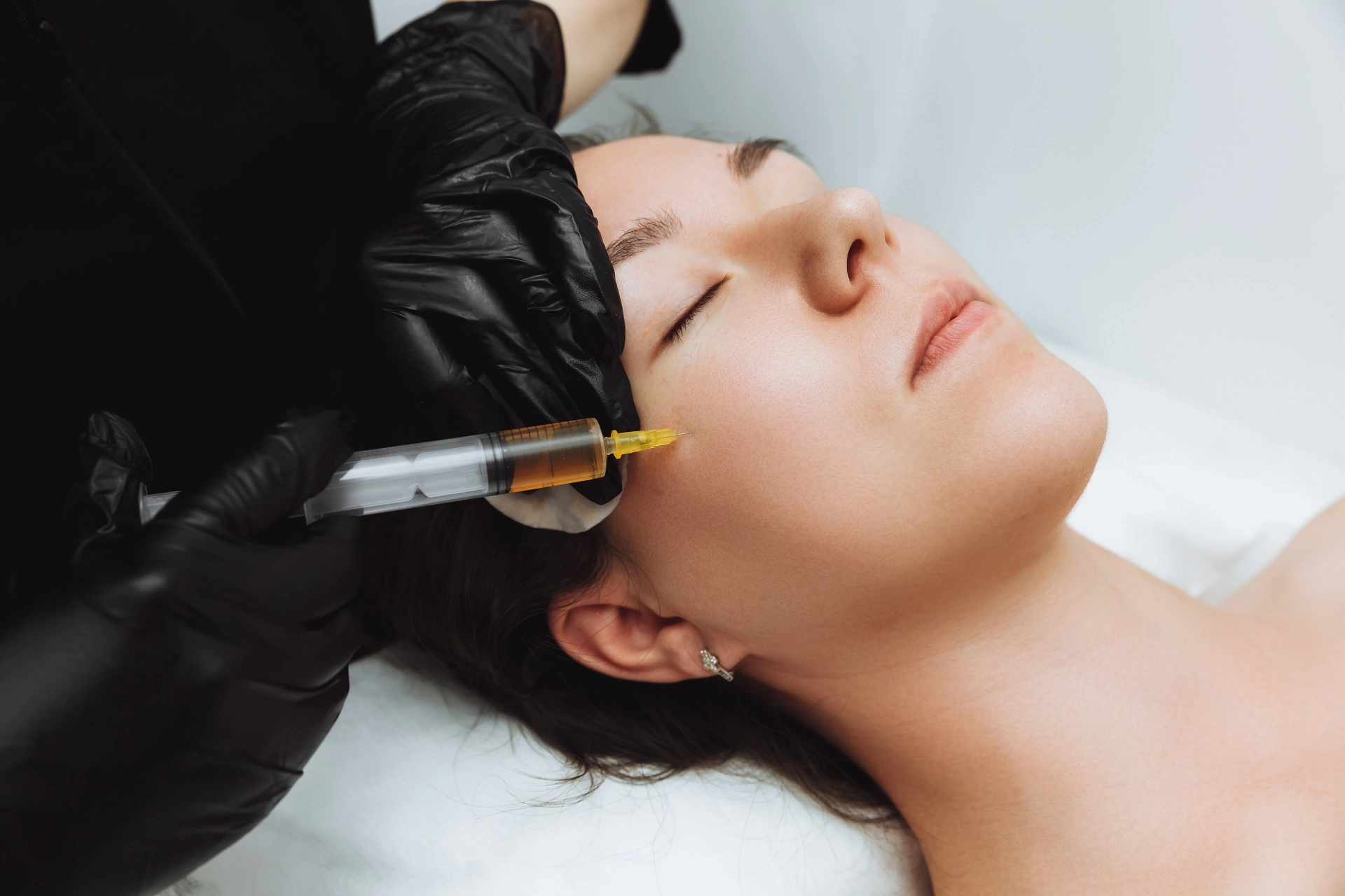 PRP and PRF | in Solon and Cleveland, OH | Euro Look Medspa