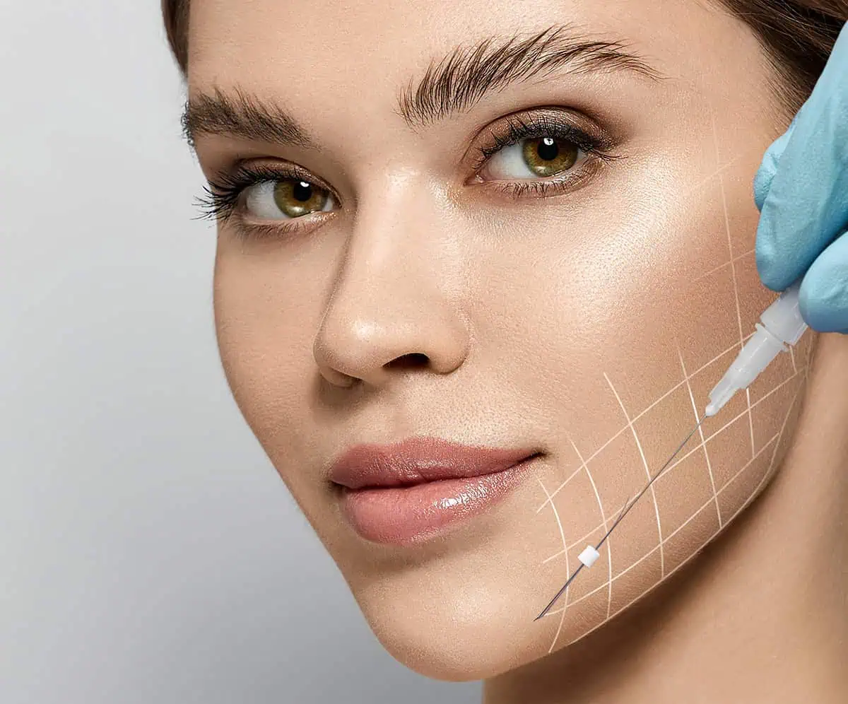 PDO Thread Lift in Cleveland, OH | Nonsurgical PDO Facelift