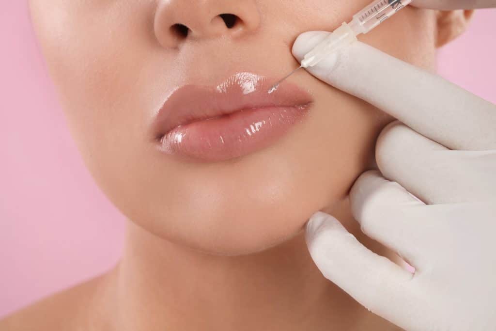 Myths and Facts About Lip Fillers You Need To Know Before Treatment | Euro Look Medical Spa in Solon, Ohio
