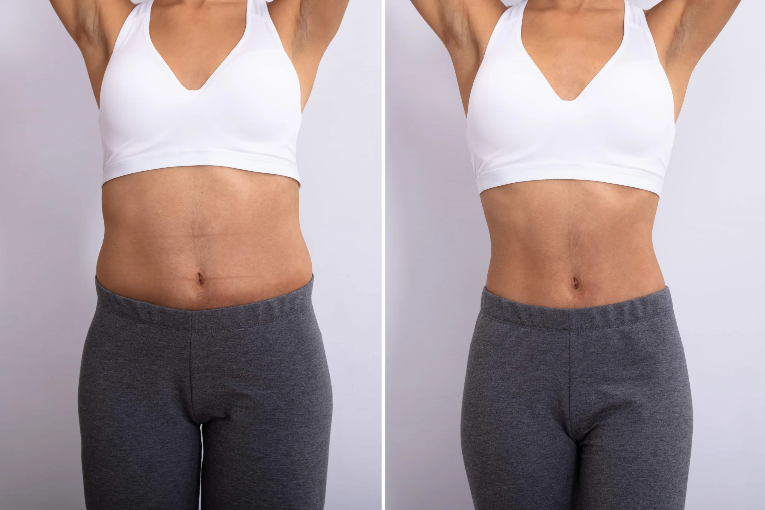 Tirzepatide Weight Loss Treatments in Solon and Cleveland, OH at Euro Look MedSpa