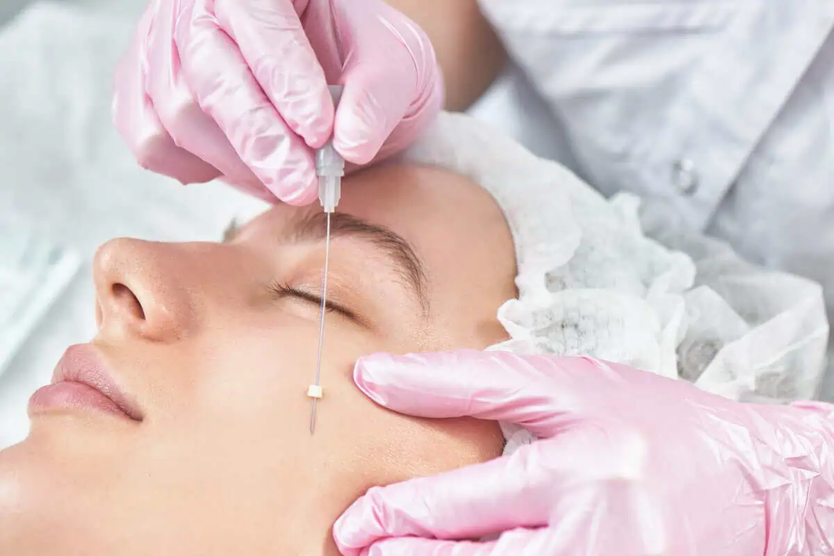 A woman is receiving PDO Thread Lift in Cleveland, OH at Euro Look Medical Spa