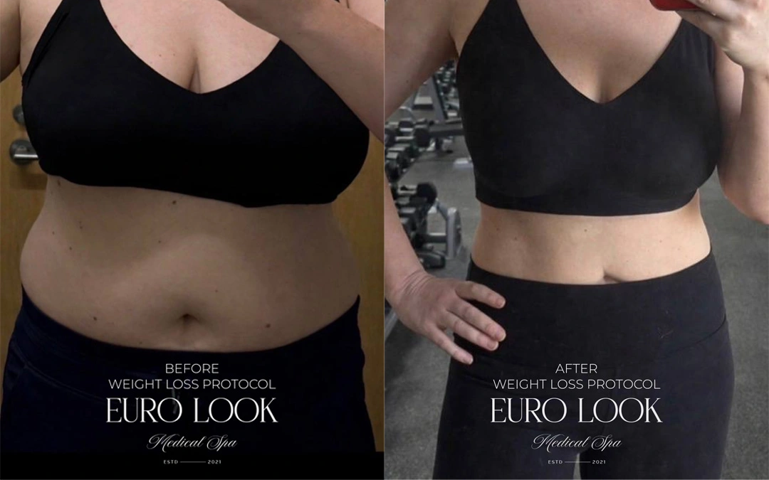 WEIGHT LOSS 1 – 284.png