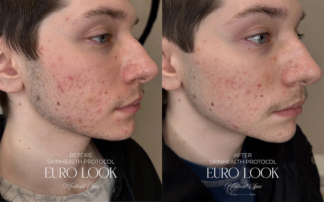 skin health 1