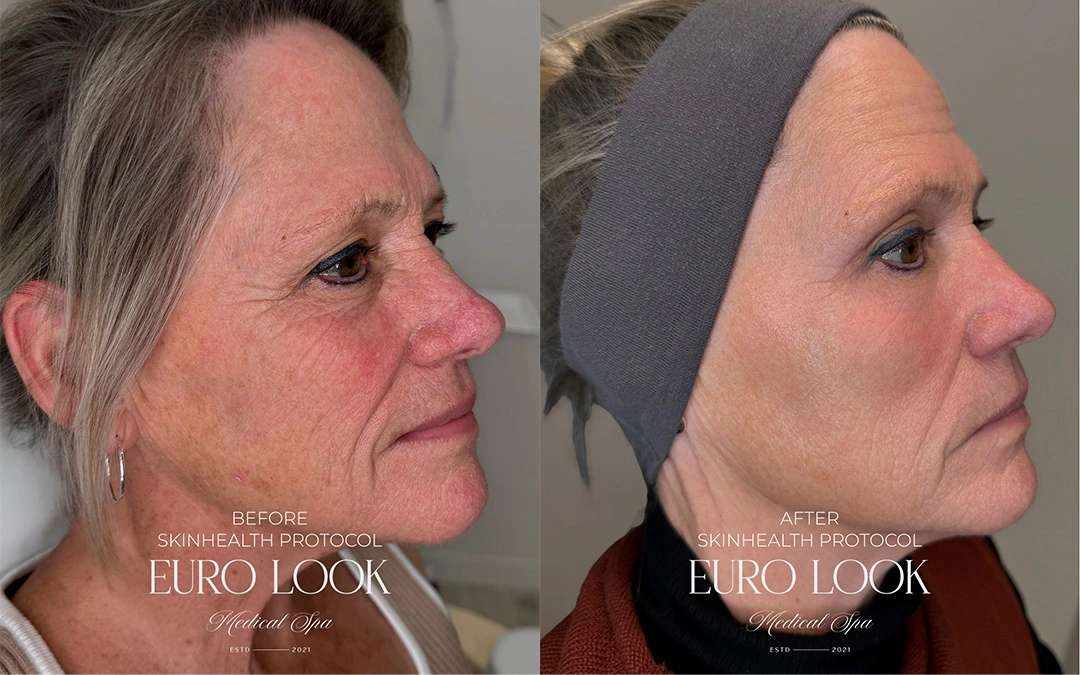 skin health 2